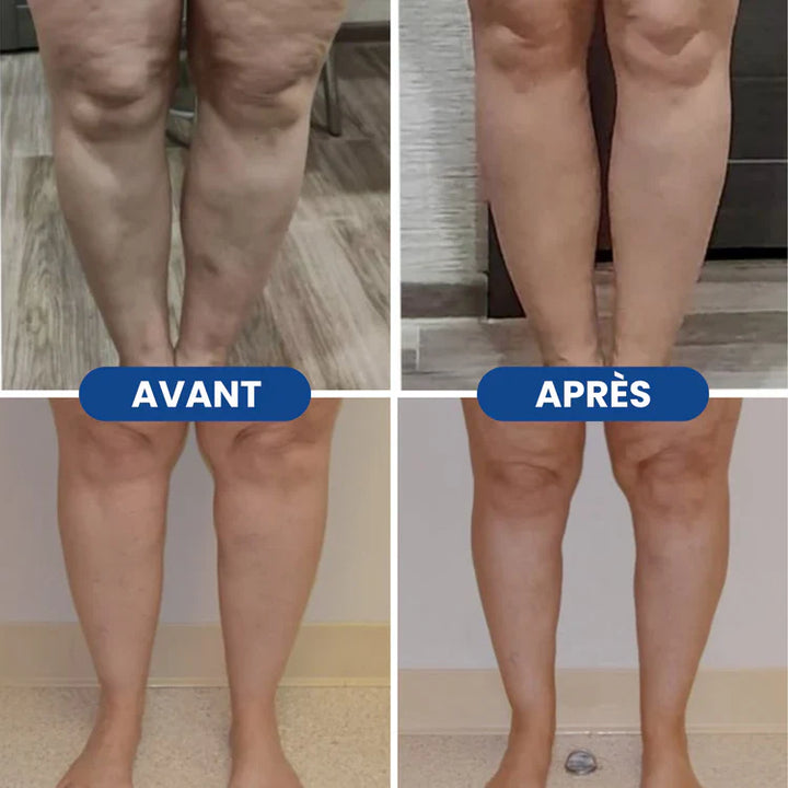 Charlie-quebec™ – Bas de Compression Confort+